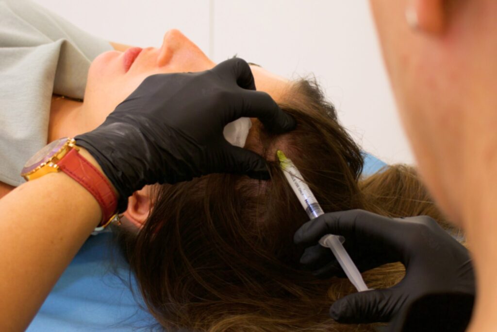 tipos alopecia