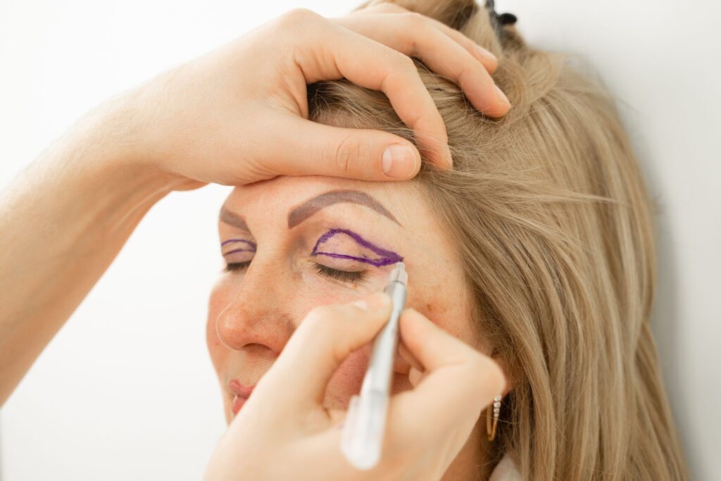 Blefaroplastia