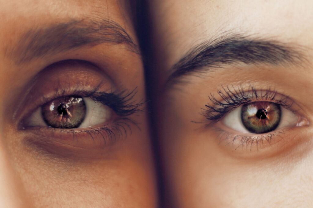 Blefaroplastia