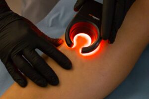 Tratamiento estetica