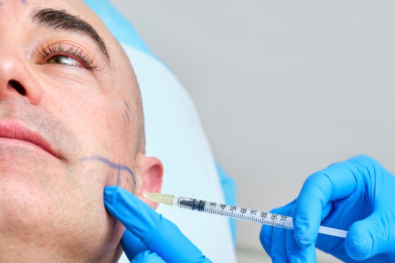 Aplicación de toxina botulínica en el masetero para el bruxismo