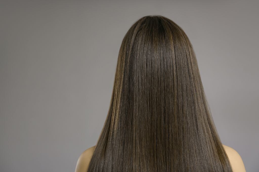 causas alopecia androgenica femenina