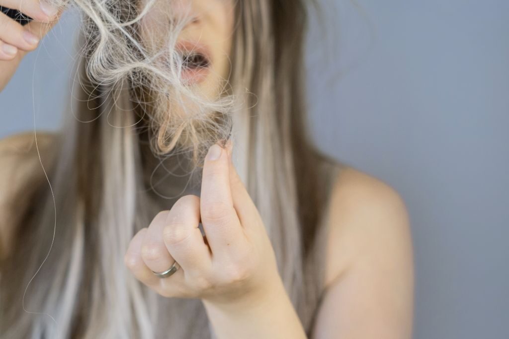 soluciones de alopecia femenina