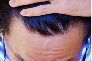 mujeres poco pelo frente (1)