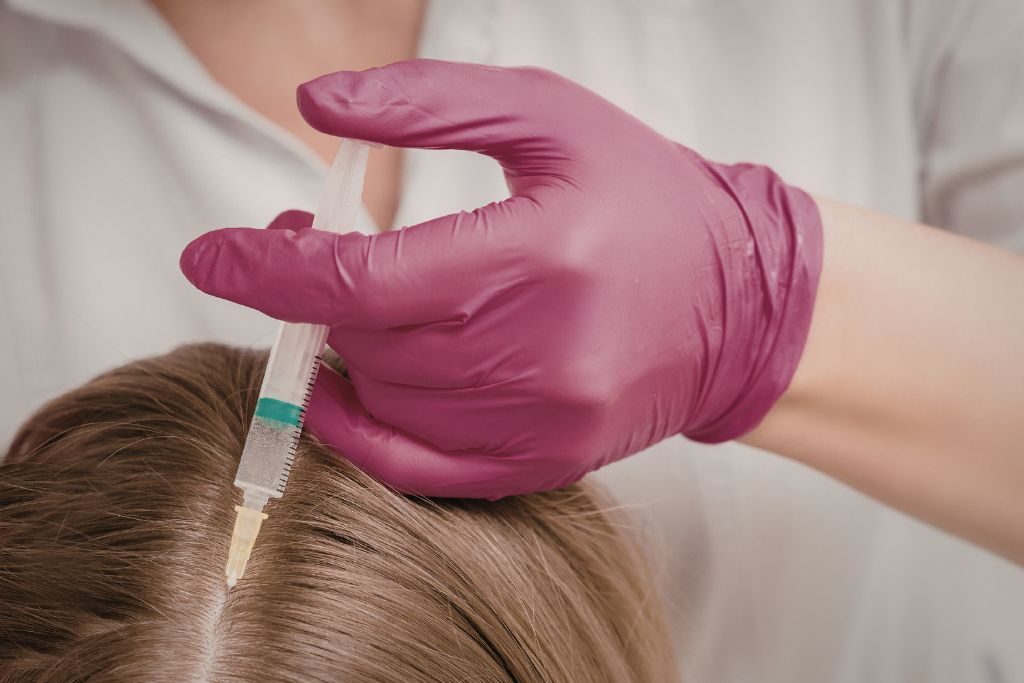 Mesoterapia capilar con exosomas: qué cambia cuando combinas ambos tratamientos 1 mesoterapia capilar con exosomas