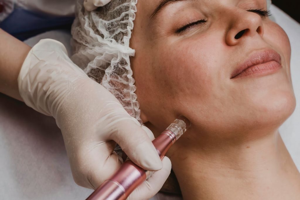 Tratamiento Zaffiro facial: qué puede hacer por tu piel y qué no 1 tratamiento zaffiro facial