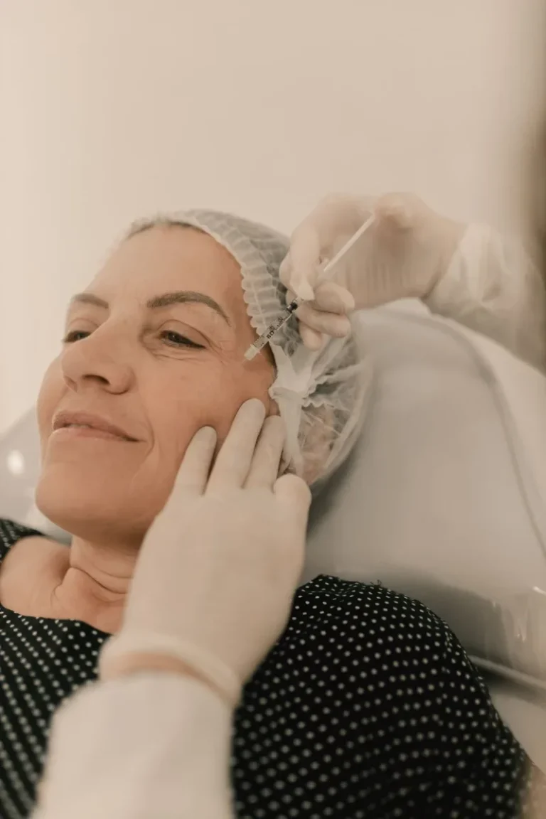 Tratamiento con Radiesse y bioestimuladores de colágeno